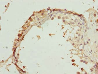 Polyclonal Rabbit anti-Human RUFY2 Antibody (IHC, WB)