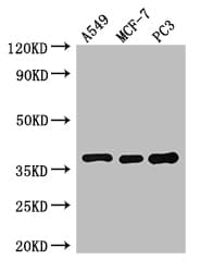 SLC9A3R2 / SIP1 Antibody