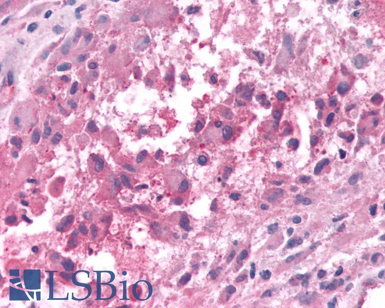 PathPlus™ GPR50 Antibody (Cytoplasmic Domain)