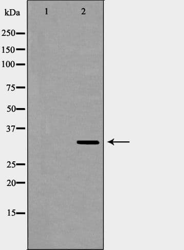RPLP0 Antibody