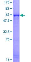 Human HADH Protein (Recombinant GST)