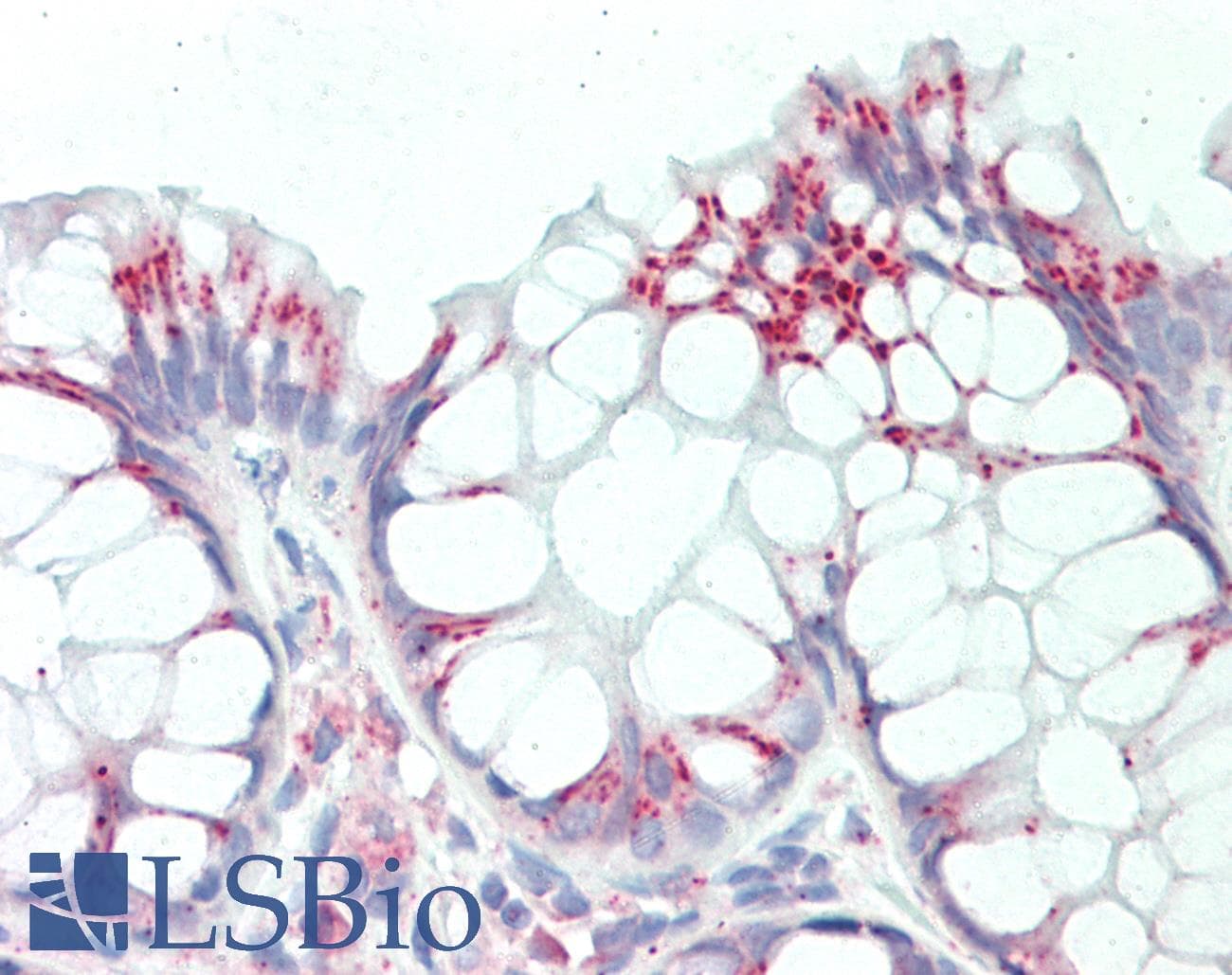RPL8 / Ribosomal Protein L8 Antibody (C-Terminus)