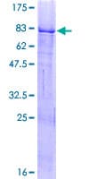 Human ZBTB6 Protein (Recombinant GST)