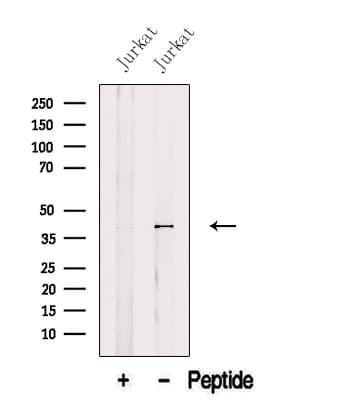 Polyclonal Rabbit anti-Human AUP1 Antibody (WB)