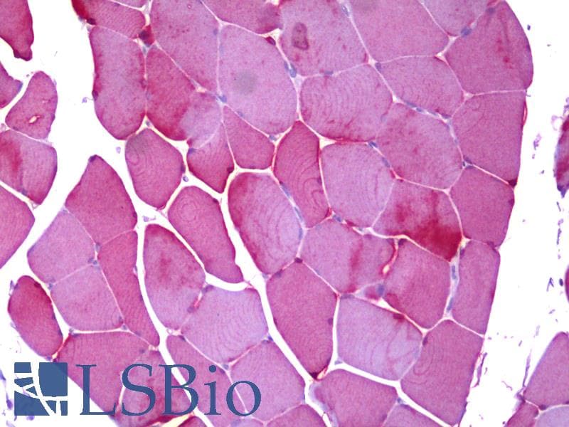 IHC-plus™ PYGM Antibody (clone 2C4)