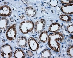 APP / Beta Amyloid Precursor Antibody (clone OTI3D11)