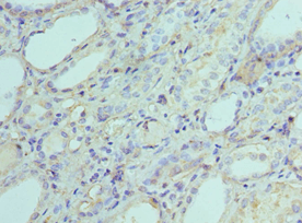 AK2 / Adenylate Kinase 2 Antibody (aa1-232)