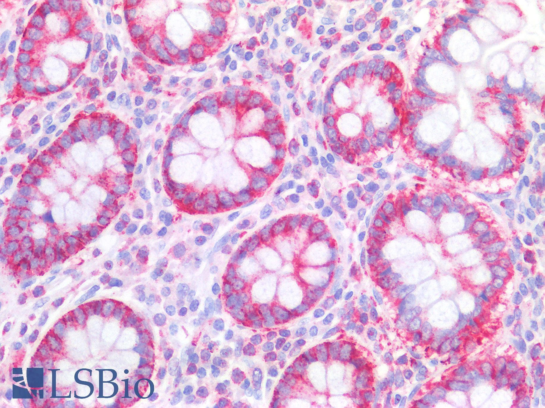 IHC-plus™ CFL1 / Cofilin Antibody (N-Terminus)