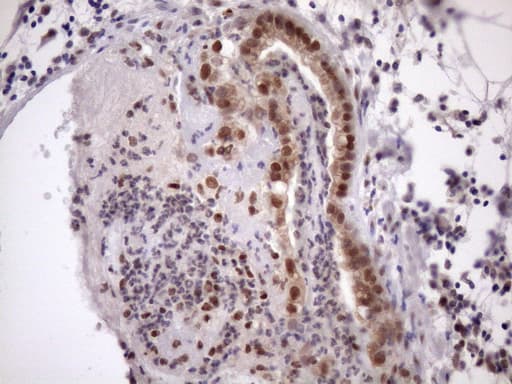 TDG / Thymine DNA Glycosylase Antibody (aa160-253, clone OTI3A12)