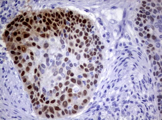 IRF6 Antibody (clone UMAB106)