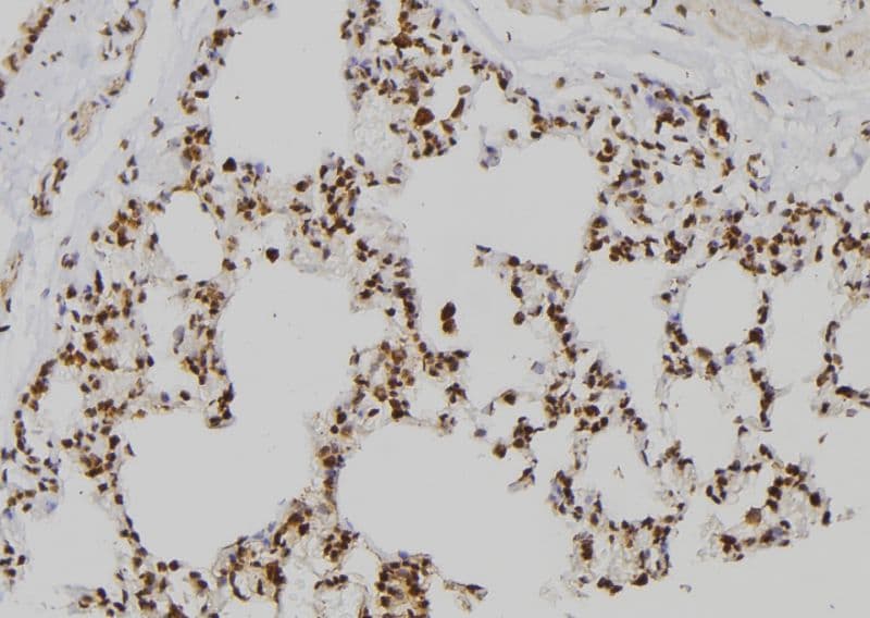 ZNF440 Antibody