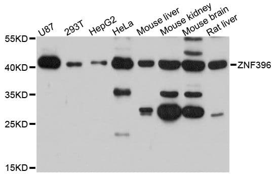 Polyclonal Rabbit anti-Human ZNF396 Antibody (WB)