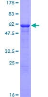 Human ASPA Protein (Recombinant GST)