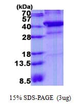 Human XRCC3 Protein (Recombinant His)