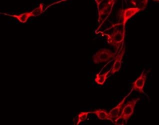 PTGR2 / PGR2 Antibody