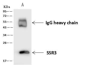 SSR3 / TRAP-Gamma Antibody