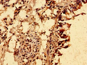 TRIM21 / RO52 Antibody