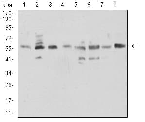 NAA10 / ARD1A Antibody (clone 3G3E9)