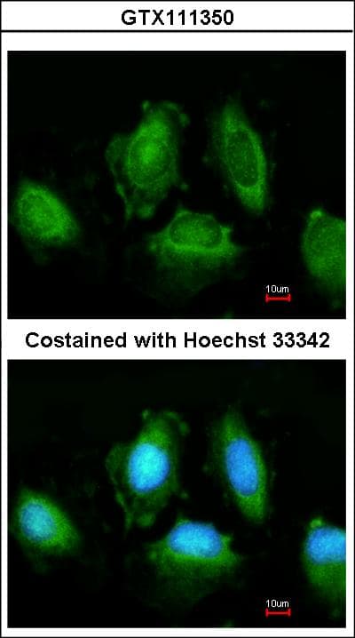 Polyclonal Rabbit anti-Human IKBKE / IKKI / IKKE Antibody (IF, WB)
