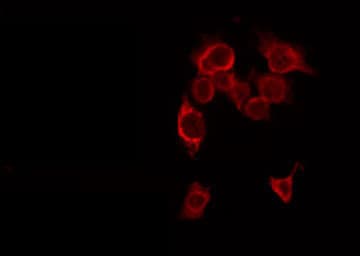 MMP16 Antibody
