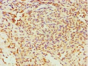 Polyclonal Rabbit anti-Human ESRRA / ERR Alpha Antibody (aa1-423, IHC)
