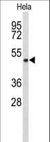 ADH6 Antibody (aa209-240)