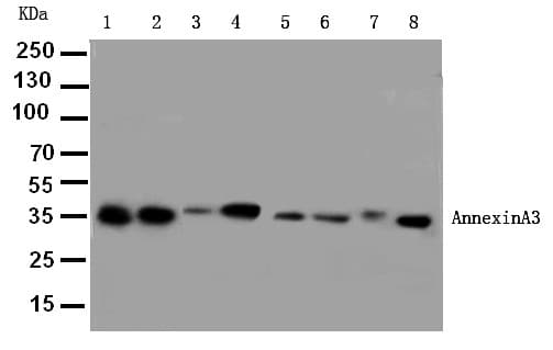 ANXA3 / Annexin A3 Antibody (aa124-141)