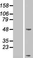 Secretin Protein (Over-Expression Lysate Myc-DDK (Flag))