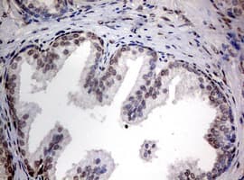 TIA-1 Antibody (clone OTI1D7)