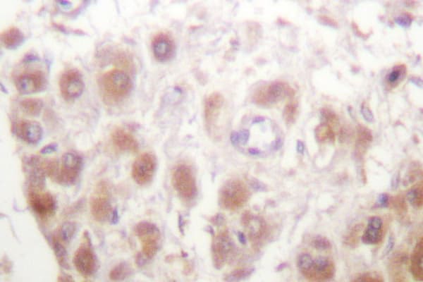 RAD52 Antibody (Asn99)