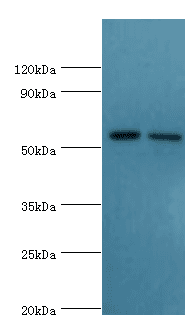 P5CDH / ALDH4A1 Antibody (aa354-563)