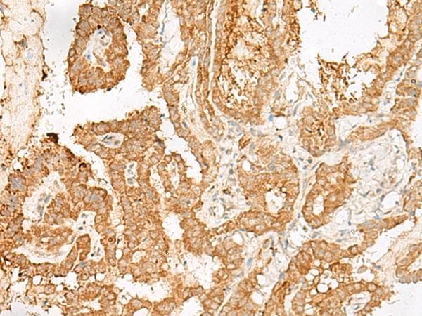 ADGRF1 / GPR110 Antibody