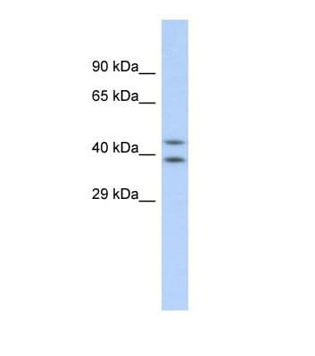 Polyclonal Rabbit anti-Human DHODH Antibody (aa69-118, IHC, WB)