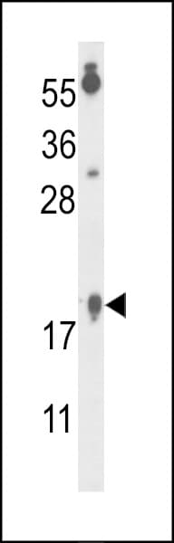 FAM96B Antibody (aa16-45)