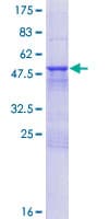 Human NXNL1 / TXNL6 Protein (Recombinant GST)