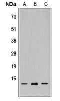 SH2D1A / SAP Antibody (Internal)