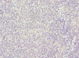 Polyclonal Rabbit anti-Human HMG1 / HMGB1 Antibody (IHC, WB)