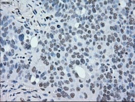 MAP2K2 / MKK2 / MEK2 Antibody (clone OTI5F6)