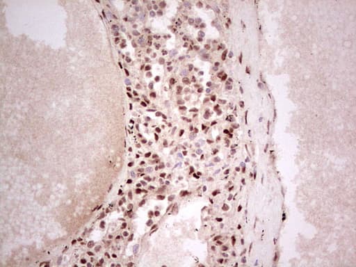 Monoclonal Mouse anti-Human NR3C1/Glucocorticoid Receptor Antibody (clone OTI3F1, aa1-265, IHC, WB)