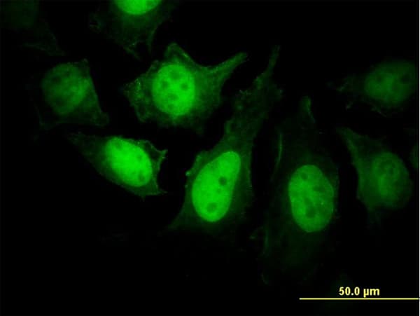 Monoclonal Mouse anti-Human PPP3R1 / Calcineurin B Antibody (clone 4E1, IF, WB)