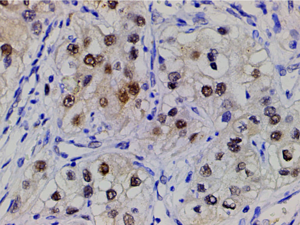 CFL1 / Cofilin Antibody (phospho-Ser3)