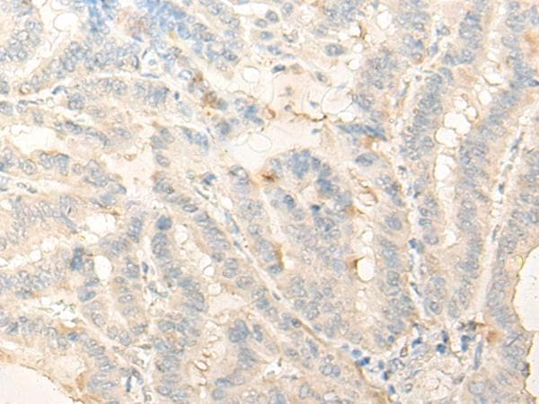 DIMT1L Antibody