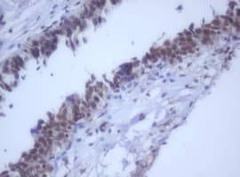 Monoclonal Mouse anti-Human DDX59 Antibody (clone OTI2G1, IHC, WB)