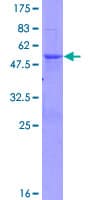 Human U2AF1L4 Protein (Recombinant GST)