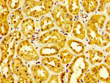 MIA2 Antibody