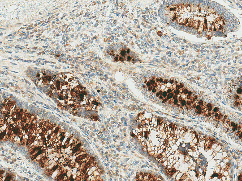 RIPK3 / RIP3 Antibody (FITC)