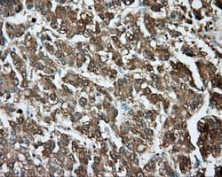 TPMT Antibody (clone OTI4C1)
