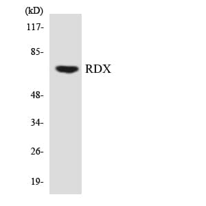 RDX / Radixin Antibody (aa126-175)