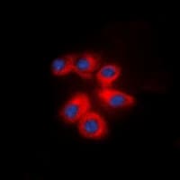 ITGB1 / Integrin Beta 1 / CD29 Antibody (C-Terminus)