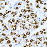Polyclonal Rabbit anti-Human TPPP3 Antibody (IHC, WB)